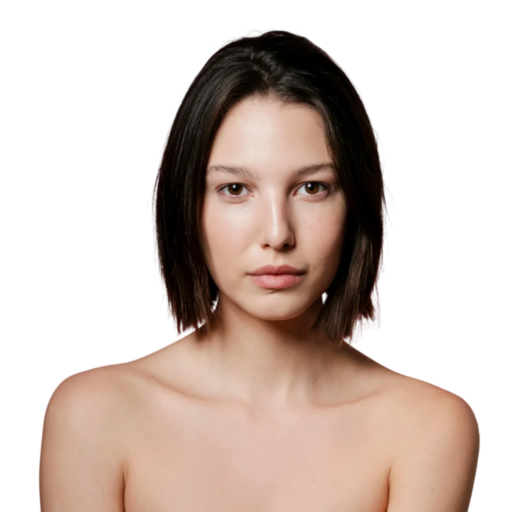 Before and after RADIESSE® treatment showing improved skin firmness and lift