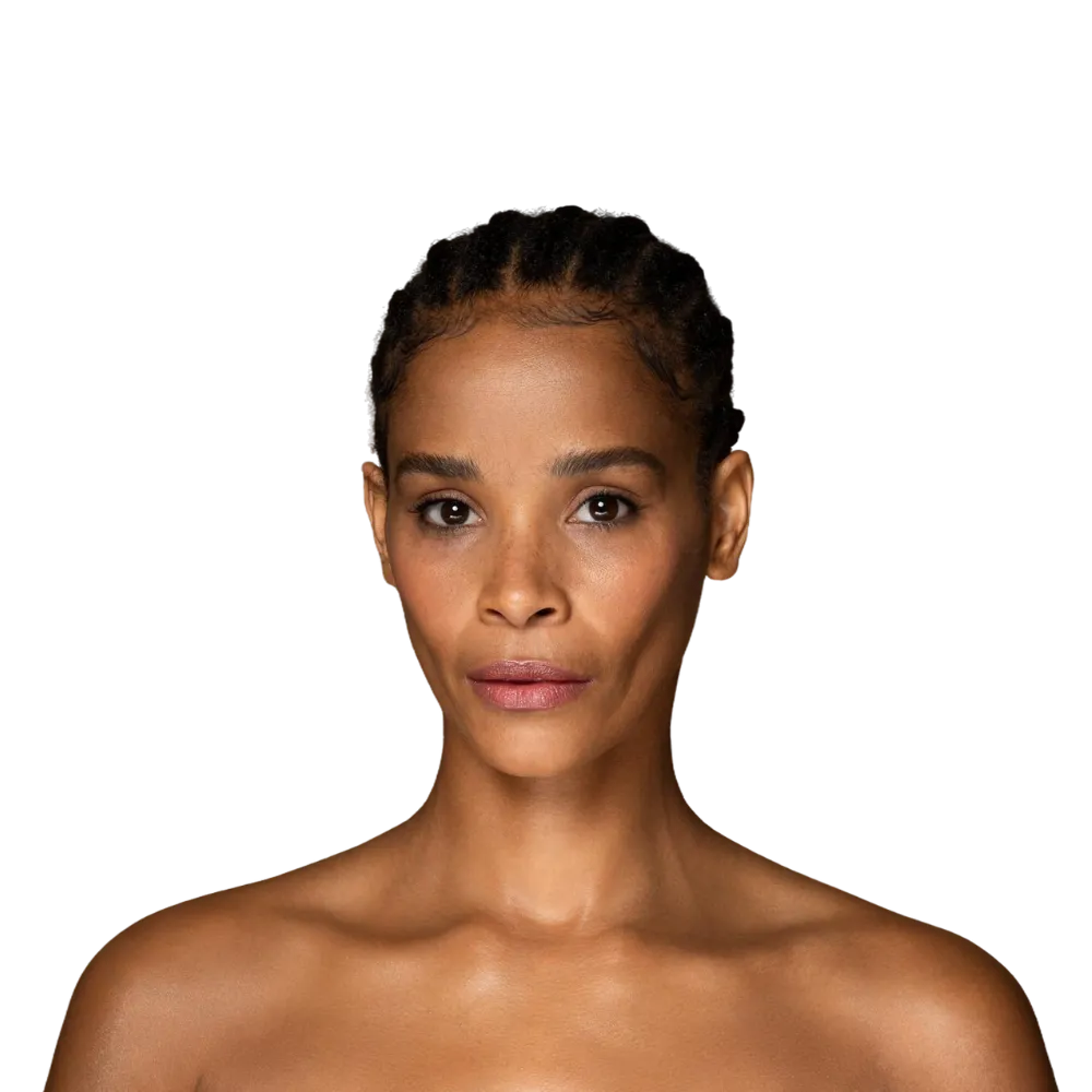 Neck & Turtleneck Tightening