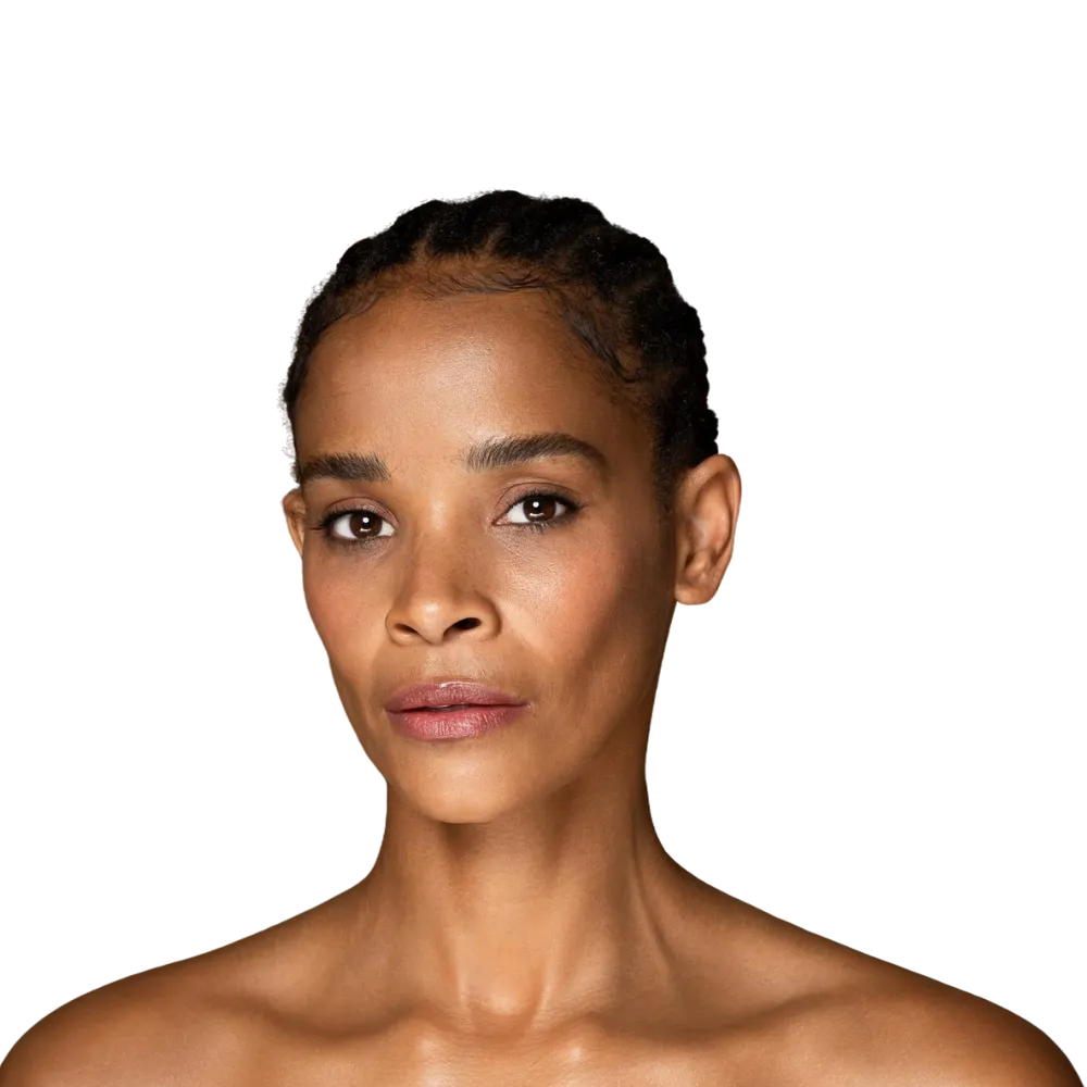 Infini RF Body Tightening Treatment