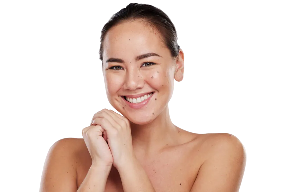 Benign skin lesion Skin Tag removal treatment at Continental Skin Clinic London