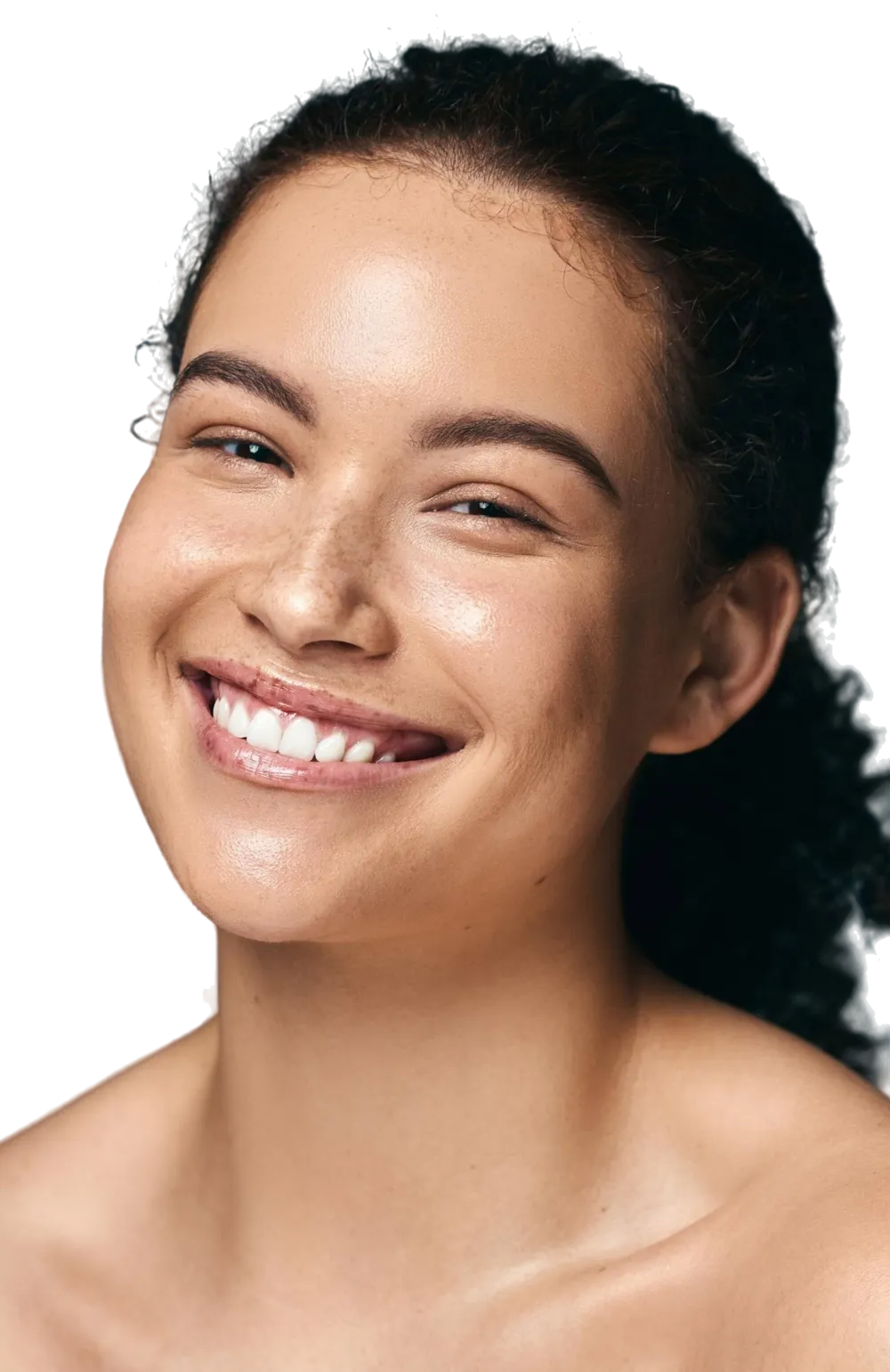 From uneven to radiant — see real results with our advanced chemical peels in London.