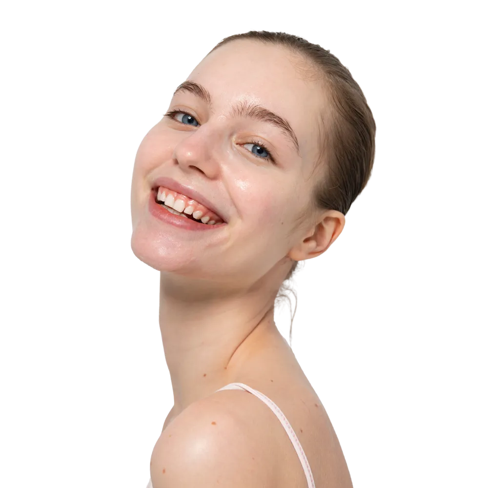 Profhilo for skin quality improvement