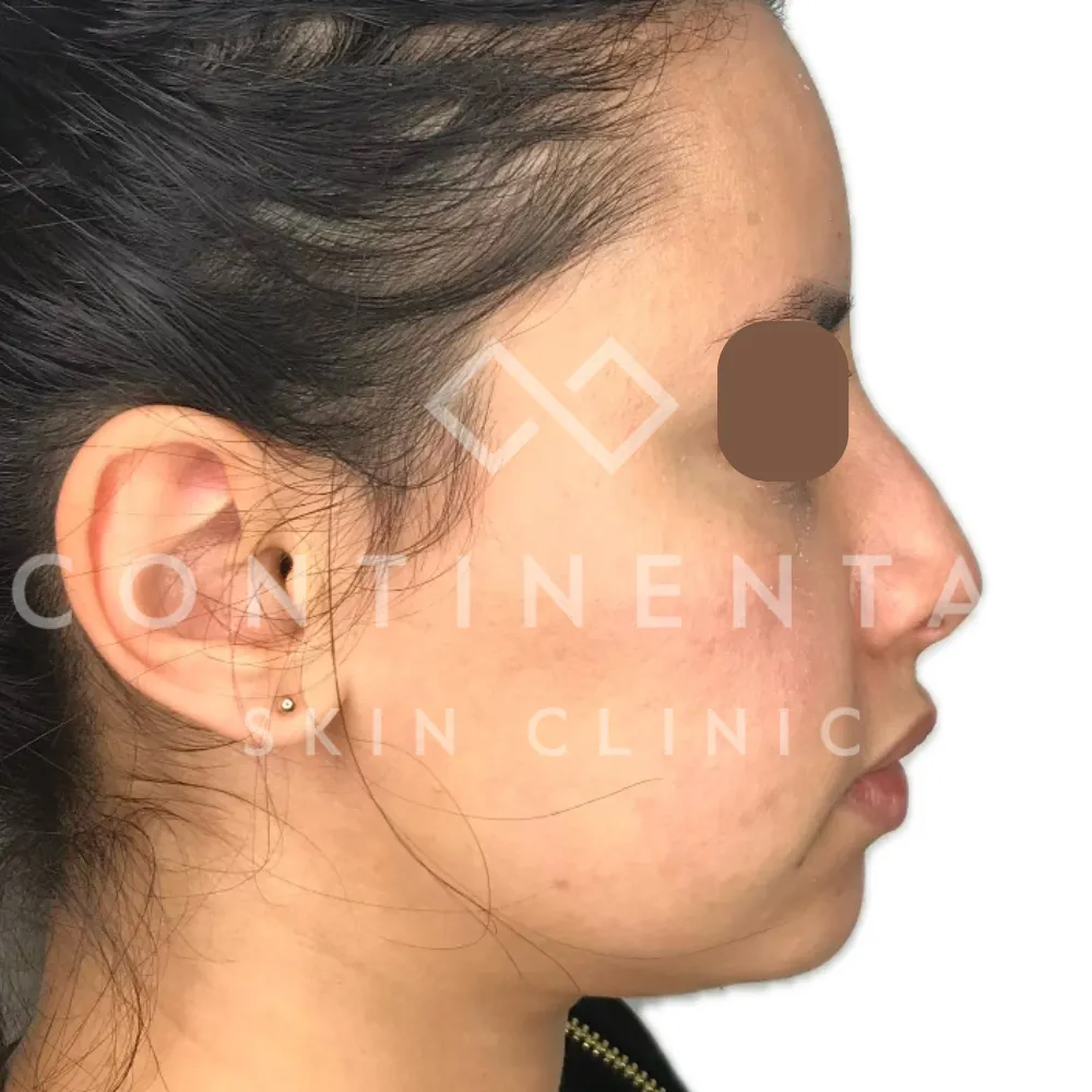 Rehab - Don't edit - Website Nov 2025