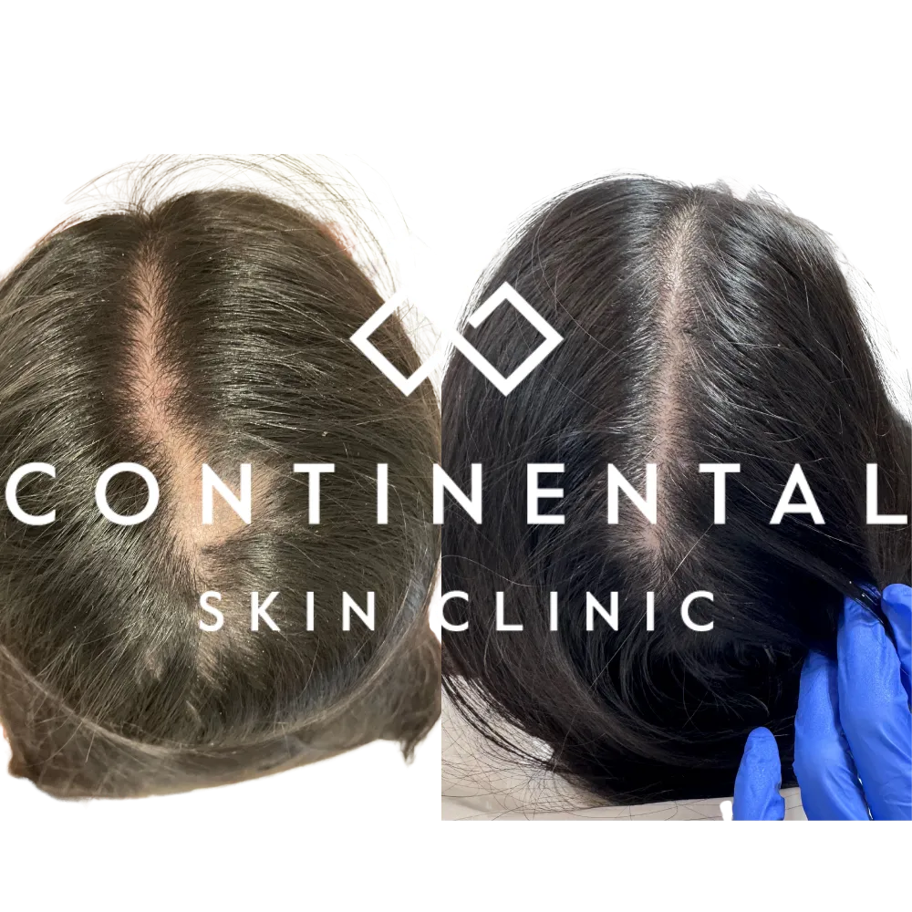 Close-up of a scalp assessment using a magnifying imaging device.