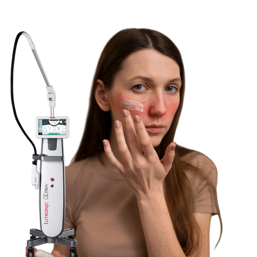 Clinician applying a topical Vitamin A Serum to the face immediately after LaseMD Ultra treatment.